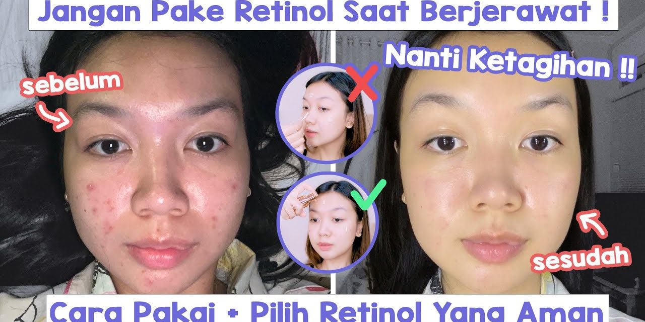 Retinol Bekerja Maksimal Jika Di Pakai Dengan Cara Ini