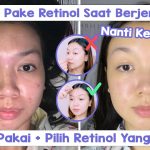 Retinol Bekerja Maksimal Jika Di Pakai Dengan Cara Ini