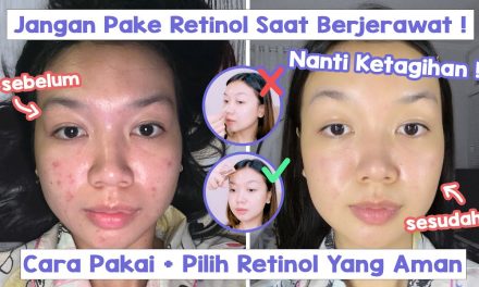Retinol Bekerja Maksimal Jika Di Pakai Dengan Cara Ini