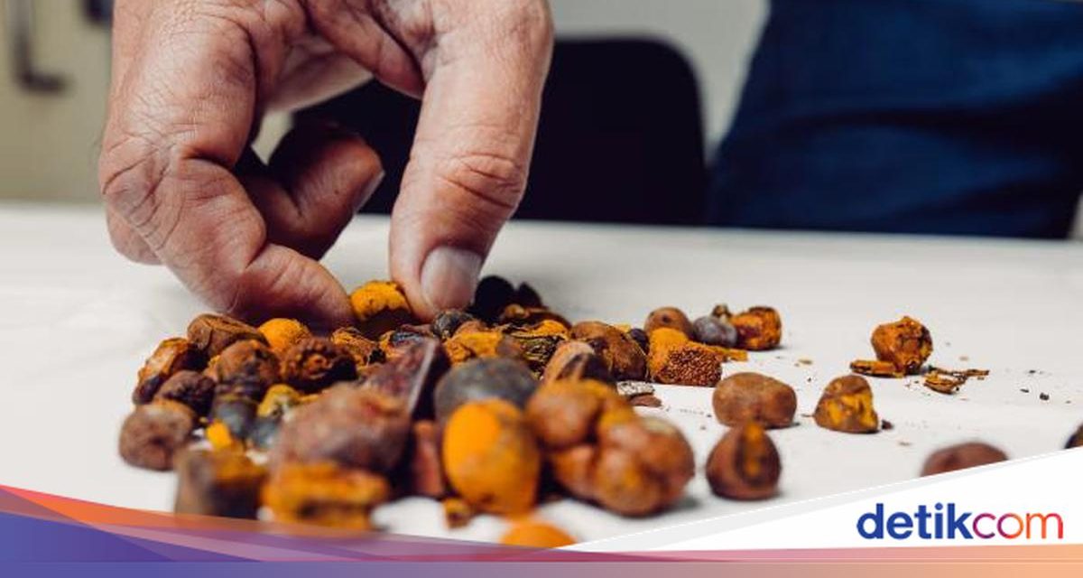 Batu Empedu Sapi Di Australia Harganya Lampaui Nilai Emas