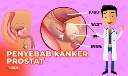 Penyakit Kanker Prostat Berkembang Di Kelenjar Prostat