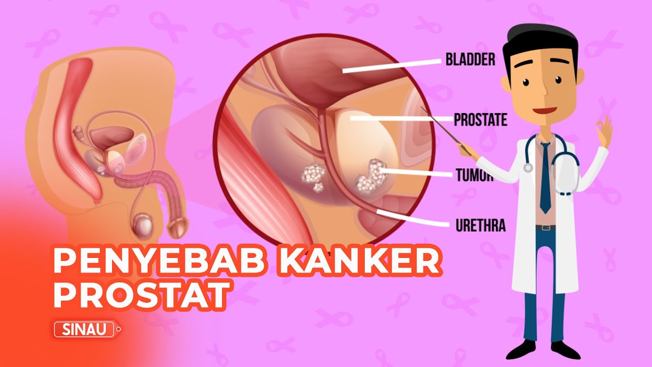 Penyakit Kanker Prostat